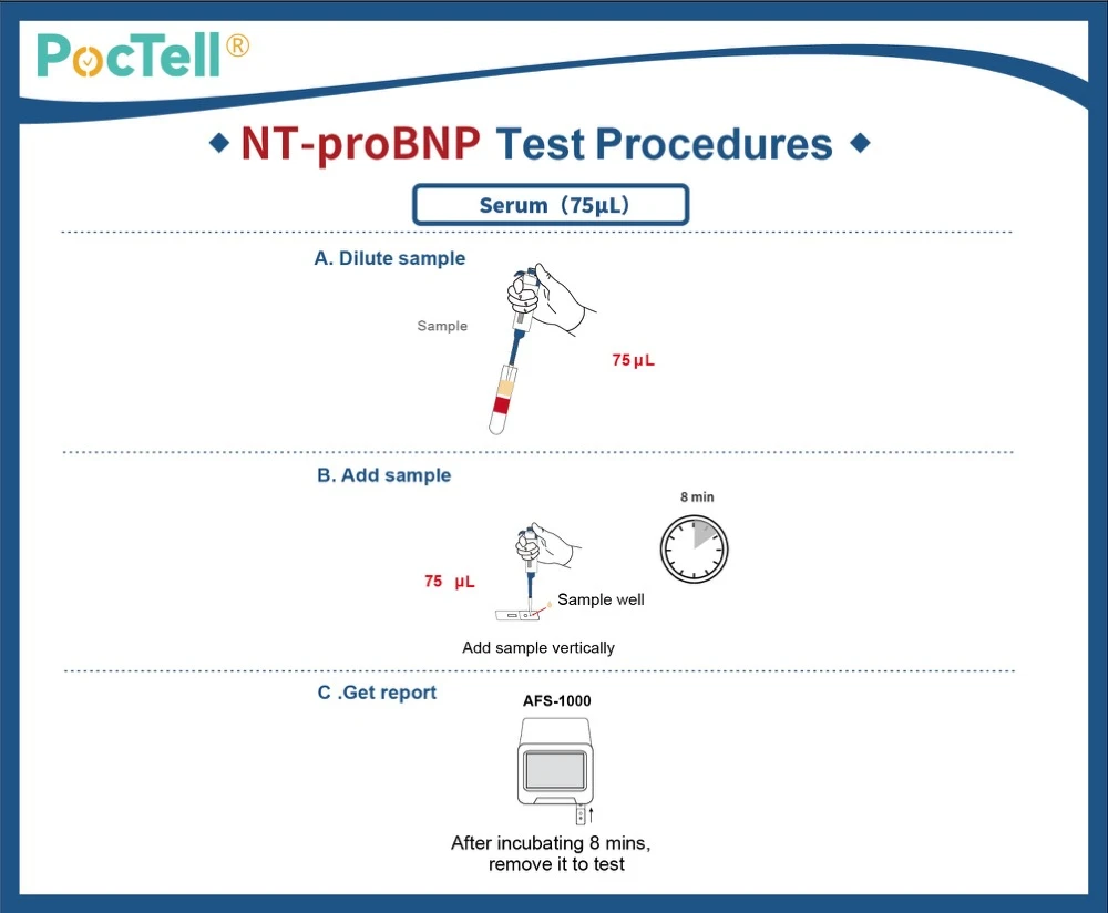 NT-proBNP test Kit Procedure NT-proBNP test Kit Procedure